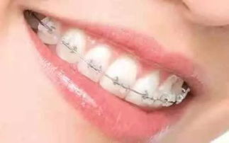 光子纳米美牙贴面 效果持久性与皮肤美容的科技之光