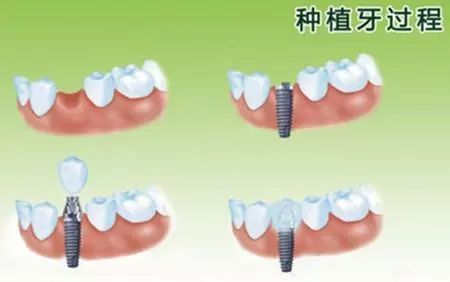 牙医的技艺，印刻在患者的口腔；皮肤美容的成果，展现在容颜的焕发