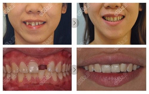 镇江十大牙科医院排名及整牙、种牙与皮肤美容推荐